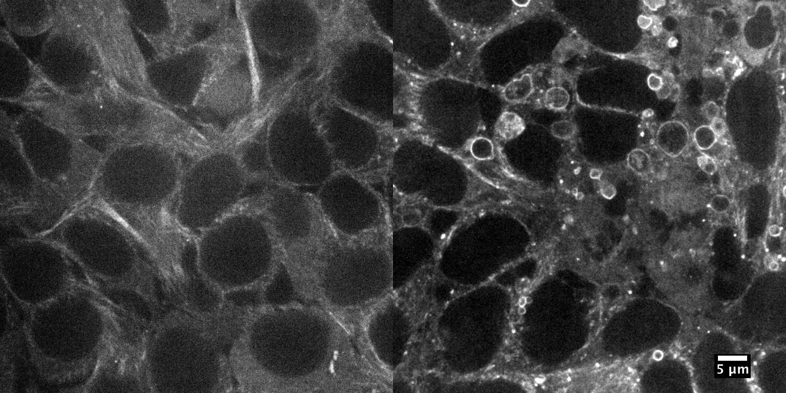 [object Object] thumbnail