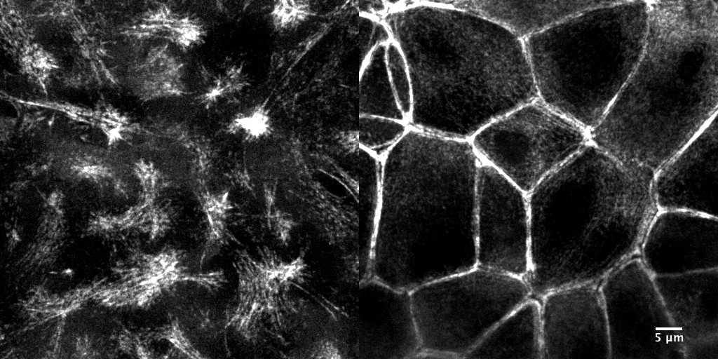 [object Object] thumbnail