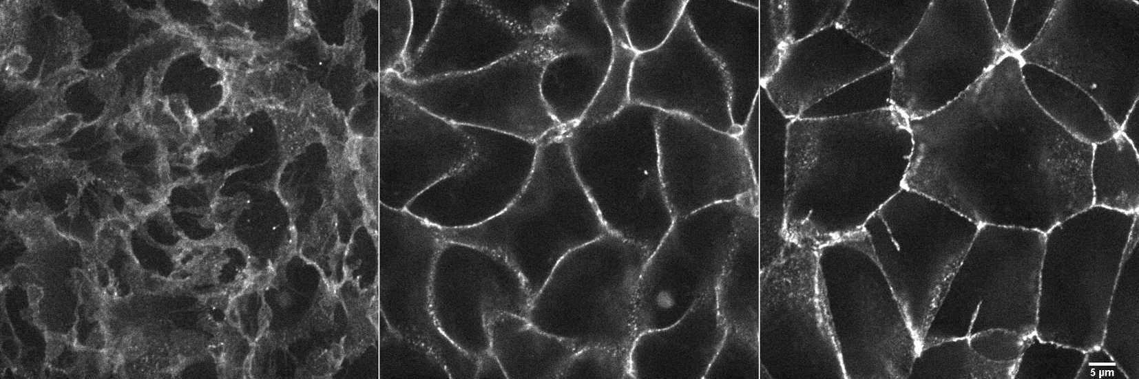 [object Object] thumbnail