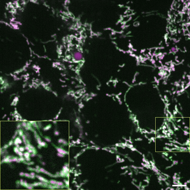 [object Object] thumbnail