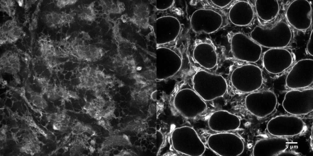 [object Object] thumbnail