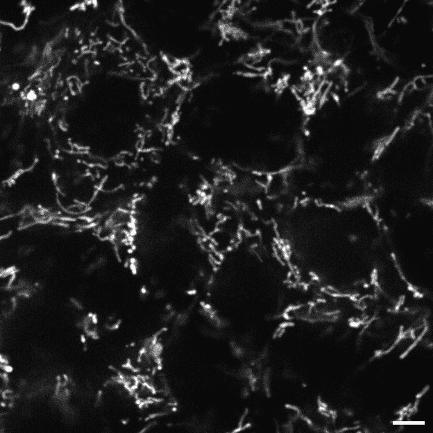 [object Object] thumbnail